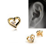 K10 Diamond Openheart